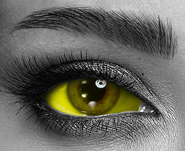 contact lenses